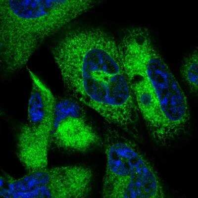 Immunocytochemistry/Immunofluorescence: JSRP1 Antibody [NBP1-81998] - Staining of human cell line RH-30 shows localization to endoplasmic reticulum. Antibody staining is shown in green.