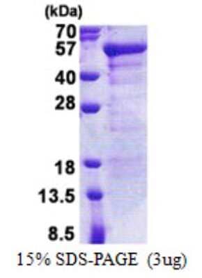 SDS-PAGE Recombinant Human JSRP1 His Protein