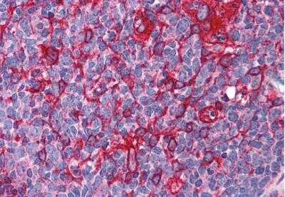 Immunohistochemistry-Paraffin: JWA Antibody [NB100-1105] - Staining of Human Tonsil. Steamed antigen retrieval with citrate buffer pH 6, AP-staining.