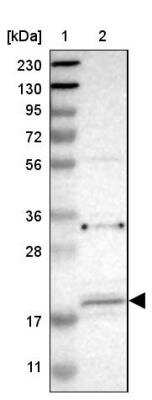 Western Blot: JWA Antibody [NBP1-84273] - Lane 1: Marker  [kDa] 230, 130, 95, 72, 56, 36, 28, 17, 11.  Lane 2: Human cell line RT-286