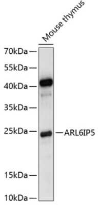 Western Blot: JWA Antibody [NBP3-03886] - Analysis of extracts of mouse thymus, using JWA antibody at 1:1000 dilution. Secondary antibody: HRP Goat Anti-Rabbit IgG (H+L) at 1:10000 dilution. Lysates/proteins: 25ug per lane. Blocking buffer: 3% nonfat dry milk in TBST. Detection: ECL Basic Kit .