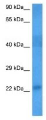 Western Blot: JWA Antibody [NBP3-09996] - Western blot analysis of JWA in Mouse Pancreas lysates. Antibody dilution at 1.0ug/ml