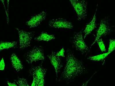Immunocytochemistry/Immunofluorescence: Jade-1/PHF17 Antibody [NBP2-98965] - Immunofluorescence staining of Jade-1/PHF17 in HeLa cells. Cells were fixed with 4% PFA, blocked with 10% serum, and incubated with rabbit anti-human Jade-1/PHF17 polyclonal antibody (1:1000) at 4C overnight. Then cells were stained with the Alexa Fluor(R)488-conjugated Goat Anti-rabbit IgG Secondary antibody (green).Positive staining was localized to cytoplasm and nucleus.