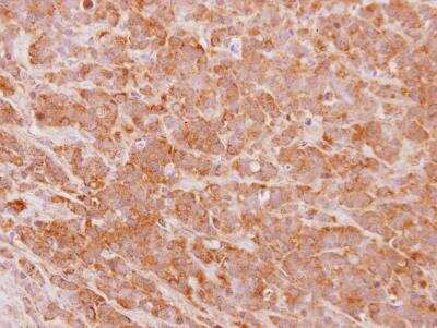 Immunohistochemistry-Paraffin: Jade-1/PHF17 Antibody [NBP2-19798] - Immunohistochemical analysis of paraffin-embedded MDA-MB157 xenograft, using antibody at 1:500 dilution.