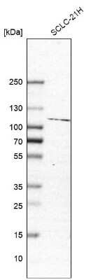 Western Blot: Jade-1/PHF17 Antibody [NBP1-83085] - Analysis in human cell line SCLC-21H.