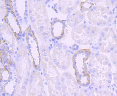 Immunohistochemistry-Paraffin: Jagged 1 Antibody (JF96-06) [NBP2-66912] - Analysis of paraffin-embedded human kidney tissue using anti-Jagged1 antibody. Counter stained with hematoxylin.
