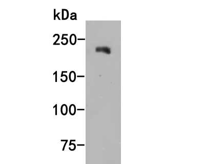Western Blot: Jagged 1 Antibody (JF96-06) [NBP2-66912] - Western blot analysis of Jagged 1 on A431 cell lysate. Proteins were transferred to a PVDF membrane and blocked with 5% BSA in PBS for 1 hour at room temperature. The primary antibody (1/1,000) was used in 5% BSA at room temperature for 2 hours. Goat Anti-Rabbit IgG - HRP Secondary Antibody (HA1001) at 1:200,000 dilution was used for 1 hour at room temperature.