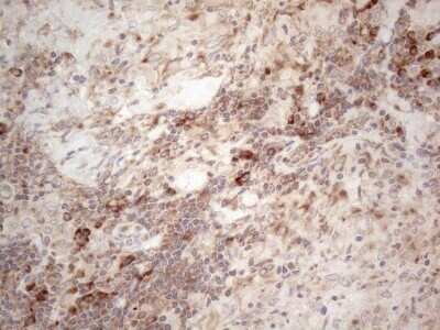 Immunohistochemistry: Jagged 1 Antibody (OTI3A10) - Azide and BSA Free [NBP2-70115] - Analysis of Human lymph node tissue. (Heat-induced epitope retrieval by 1mM EDTA in 10mM Tris buffer (pH8.5) at 120C for 3 min)