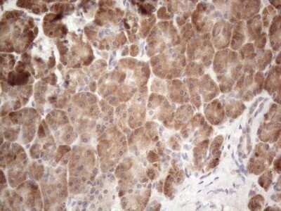 Immunohistochemistry: Jagged 1 Antibody (OTI3A10) - Azide and BSA Free [NBP2-70115] - Analysis of Human pancreas tissue. (Heat-induced epitope retrieval by 1mM EDTA in 10mM Tris buffer (pH8.5) at 120C for 3 min)