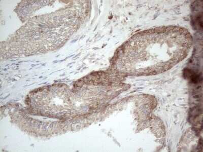 Immunohistochemistry: Jagged 1 Antibody (OTI3A10) - Azide and BSA Free [NBP2-70115] - Analysis of Human prostate tissue. (Heat-induced epitope retrieval by 1mM EDTA in 10mM Tris buffer (pH8.5) at 120C for 3 min)