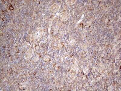 Immunohistochemistry: Jagged 1 Antibody (OTI3A10) - Azide and BSA Free [NBP2-70115] - Analysis of Human tonsil tissue. (Heat-induced epitope retrieval by 1mM EDTA in 10mM Tris buffer (pH8.5) at 120C for 3 min)