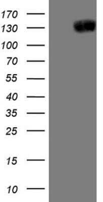 Western Blot: Jagged 1 Antibody (OTI3A10) - Azide and BSA Free [NBP2-70115] - Analysis of HEK293T cells were transfected with the pCMV6-ENTRY control (Left lane) or pCMV6-ENTRY Jagged 1.