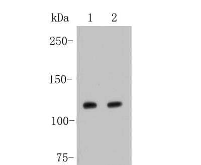Western Blot: Jak2 Antibody (SY0245) [NBP2-67430] - Analysis of JAK2 on different lysates. Proteins were transferred to a PVDF membrane and blocked with 5% BSA in PBS for 1 hour at room temperature. The primary antibody (1/500) was used in 5% BSA at room temperature for 2 hours. Goat Anti-Rabbit IgG - HRP Secondary Antibody at 1:5,000 dilution was used for 1 hour at room temperature. Positive control:  Lane 1: A549 cell lysateLane 2: MCF-7 cell lysate