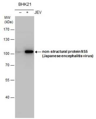 Western Blot: Japanese Encephalitis virus NS5 Antibody [NBP3-13016] - NS5 (JEV) antibody detects NS5 (JEV) protein by Western blot analysis. Un-infected (-) and infected (+, JEV infection) BHK-21 whole cell extracts (5 ug) were separated by 7.5% SDS-PAGE, and the membrane was blotted with NS5 (JEV) antibody (NBP3-13016) at a dilution of 1:3000 and developed with Trident femto Western HRP Substrate.