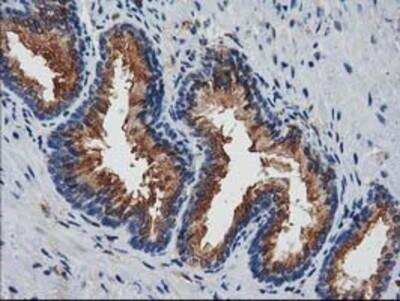 Immunohistochemistry-Paraffin: Josephin1 Antibody (3B11) [NBP2-03442] - Staining of paraffin-embedded Human prostate tissue using anti-Josephin1 mouse monoclonal antibody.