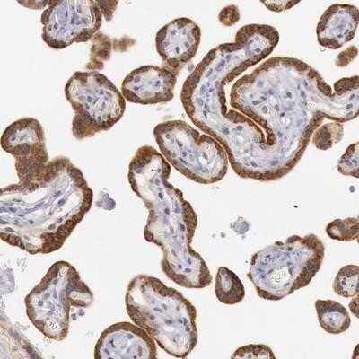 Immunohistochemistry-Paraffin Josephin1 Antibody - BSA Free