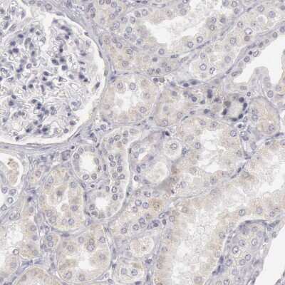 Immunohistochemistry-Paraffin Josephin1 Antibody - BSA Free