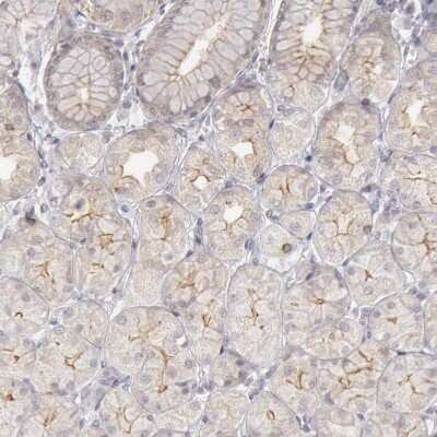Immunohistochemistry-Paraffin Josephin1 Antibody - BSA Free