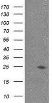 Western Blot: Josephin1 Antibody (OTI3B11) - Azide and BSA Free [NBP2-71506] - HEK293T cells were transfected with the pCMV6-ENTRY control (Left lane) or pCMV6-ENTRY Josephin1 (Right lane) cDNA for 48 hrs and lysed. Equivalent amounts of cell lysates (5 ug per lane) were separated by SDS-PAGE and immunoblotted with anti-Josephin1.
