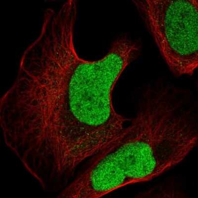 Immunocytochemistry/Immunofluorescence: Jun Antibody [NBP2-56932] - Staining of human cell line U-2 OS shows localization to nucleoplasm.