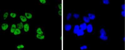 Immunocytochemistry/Immunofluorescence: JunD Antibody (SD0830) [NBP2-67826] - Staining JunD in Hela cells (green). The nuclear counter stain is DAPI (blue). Cells were fixed in paraformaldehyde, permeabilised with 0.25% Triton X100/PBS.