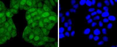Immunocytochemistry/Immunofluorescence: JunD [p Ser255] Antibody (JJ08-21) [NBP2-67861] - Staining Phospho-JunD(S255) in Hela cells (green). The nuclear counter stain is DAPI (blue). Cells were fixed in paraformaldehyde, permeabilised with 0.25% Triton X100/PBS.