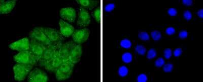 Immunocytochemistry/Immunofluorescence: JunD [p Ser255] Antibody (JJ08-21) [NBP2-67861] - Staining Phospho-JunD(S255) in HepG2 cells (green). The nuclear counter stain is DAPI (blue). Cells were fixed in paraformaldehyde, permeabilised with 0.25% Triton X100/PBS.