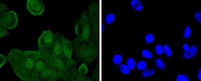 Immunocytochemistry/Immunofluorescence: JunD [p Ser255] Antibody (JJ08-21) [NBP2-67861] - Staining Phospho-JunD(S255) in MCF-7 cells (green). The nuclear counter stain is DAPI (blue). Cells were fixed in paraformaldehyde, permeabilised with 0.25% Triton X100/PBS.