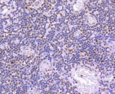 Immunohistochemistry-Paraffin: JunD [p Ser255] Antibody (JJ08-21) [NBP2-67861] - Analysis of paraffin-embedded human tonsil tissue using anti-Phospho-JunD(S255) antibody. Counter stained with hematoxylin.