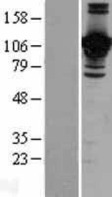 Western Blot JAM-B/VE-JAM Overexpression Lysate