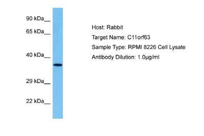 Western Blot: Junctional Cadherin Complex Regulator Antibody [NBP2-87651] - Host: Rabbit. Target Name: C11ORF63. Sample Tissue: Human RPMI 8226 Whole Cell lysates. Antibody Dilution: 1ug/ml