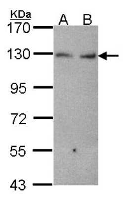 Western Blot: K Cadherin Antibody [NBP2-17012] - Sample (30 ug of whole cell lysate) A: Hela B: JurKat 7. 5% SDS PAGE gel, diluted at 1:1000.