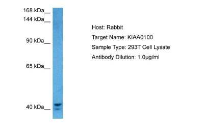 Host: Rabbit. Target Name: BLTP2. Sample Tissue: Human 293T Whole Cell lysates. Antibody Dilution: 1ug/ml