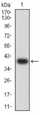 Western Blot: KA2/GRIK5/Glutamate Receptor KA2 Antibody (4G5H8) [NBP2-61804] - Analysis using GRIK5 mAb against human GRIK5 (AA: extra 21-166) recombinant protein. (Expected MW is 39 kDa)