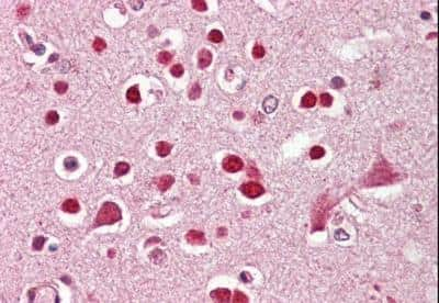 Immunohistochemistry-Paraffin: KA2/GRIK5/Glutamate Receptor KA2 Antibody [NBP1-36959] - (3.75ug/ml) staining of paraffin embedded Human Cortex. Steamed antigen retrieval with citrate buffer pH 6, AP-staining.