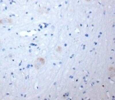 Immunohistochemistry-Paraffin: KA2/GRIK5/Glutamate Receptor KA2 Antibody [NBP1-46488] - Rat spinal cord (paraffin section) using Rabbit antibody to 1t extracellular domain of GRIK5 (EAA2, Glutamate receptor KA-2): whole serum at 1 : 200 dilution incubated overnight at 4C, developed with DAB/Ni and counterstained with hema