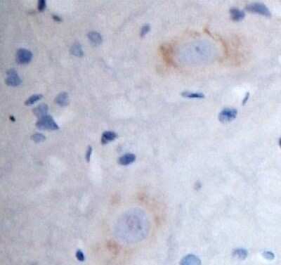 Immunohistochemistry-Paraffin: KA2/GRIK5/Glutamate Receptor KA2 Antibody [NBP1-46488] - IHC on rat spinal cord (paraffin section) using Rabbit antibody to 1t extracellular domain of GRIK5 (EAA2, Glutamate receptor KA-2): whole serum at 1 : 200 dilution incubated overnight at 4C, developed with DAB/Ni and counterstained with hematoxylin.