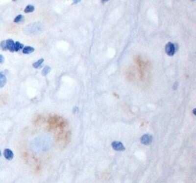 Immunohistochemistry-Paraffin: KA2/GRIK5/Glutamate Receptor KA2 Antibody [NBP1-46488] - IHC on rat spinal cord (paraffin section) using Rabbit antibody to 1t extracellular domain of GRIK5 (EAA2, Glutamate receptor KA-2): whole serum at 1 : 200 dilution incubated overnight at 4C, developed with DAB/Ni and counterstained with hematoxylin.