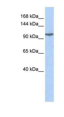 Western Blot: KA2/GRIK5/Glutamate Receptor KA2 Antibody [NBP1-80270] - Jurkat cell lysate. Suggested Antibody Titration: 0.2 - 1 ug/mL.