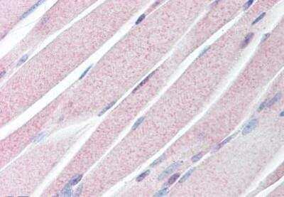 Immunohistochemistry-Paraffin: KAL1 Antibody [NBP1-02547] - Staining of human skeletal muscle. Immunohistochemistry of formalin-fixed, paraffin-embedded tissue after heat-induced antigen retrieval. Antibody concentration 40 ug/ml.