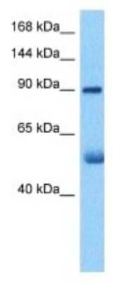 Western Blot: KALRN Antibody [NBP3-10025] - Western blot analysis of KALRN in Lung Tumor lysates. Antibody dilution at 1ug/ml