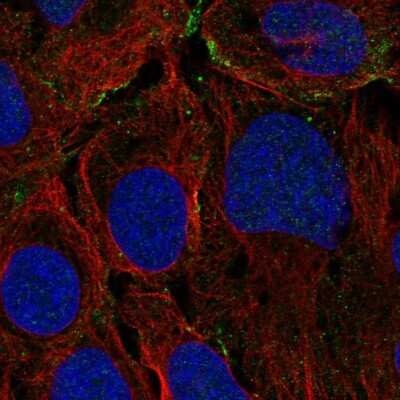 Immunocytochemistry/Immunofluorescence: KANK3 Antibody [NBP2-14138] - Staining of human cell line U-2 OS shows localization to plasma membrane.