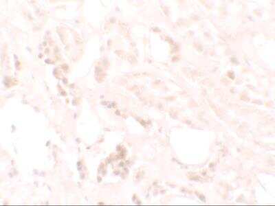 Immunohistochemistry: KANK3 Antibody [NBP2-82100] - Immunohistochemistry of KANK3 in human kidney tissue with KANK3 antibody at 2.5 ug/ml.