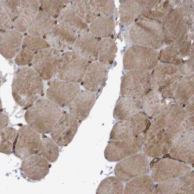 Immunohistochemistry-Paraffin KANK3 Antibody - BSA Free