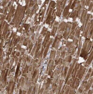 Immunohistochemistry-Paraffin KANK3 Antibody - BSA Free