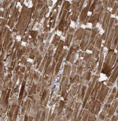 Immunohistochemistry-Paraffin: KANK3 Antibody [NBP2-14138] - Staining of human heart muscle shows strong cytoplasmic positivity in cardiomyocytes.