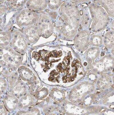 Immunohistochemistry-Paraffin: KANK3 Antibody [NBP2-14138] - Staining of human kidney shows strong membranous and ctyoplasmic positivity in cells in glomeruli.