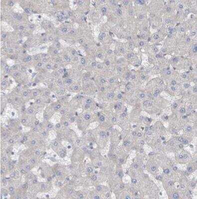 Immunohistochemistry-Paraffin: KANK3 Antibody [NBP2-14138] - Stainng of human liver shows no positivity in hepatocytes.