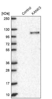 Western Blot: KANK3 Antibody [NBP2-14138] - Analysis in control (vector only transfected HEK293T lysate) and KANK3 over-expression lysate (Co-expressed with a C-terminal myc-DDK tag (3.1 kDa) in mammalian HEK293T cells).