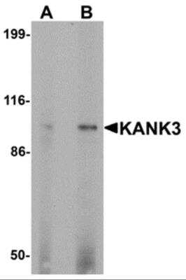 Western Blot: KANK3 Antibody [NBP2-82100] - Analysis of KANK3 in A431 cell lysate with KANK3 antibody at (A) 1 and (B) 2 ug/ml.